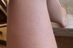 SUPER HAIRY PHOTOSET
