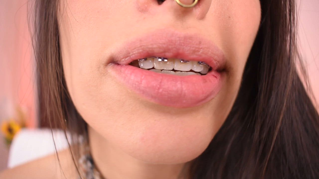 flash braces