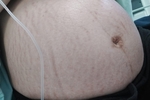 Pregnancy in Hospital