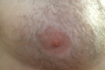caxser