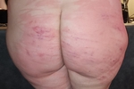 ass beating