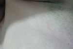 armpit