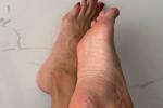 feet
