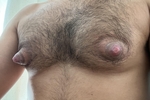 Nipples