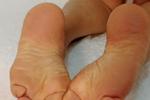 FEET