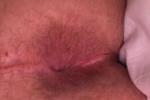 londonlad2002x — Hole and Arse