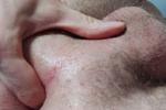 Anal
