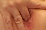Butthole