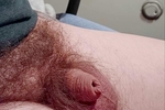 Foreskin