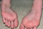 Sweat feet🎔