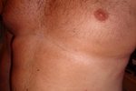 Hairy/shaved