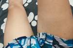 En cama