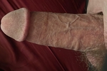 Dick