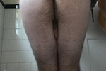 Stinky asshole pic set ;)