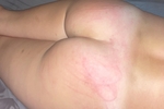 Ass