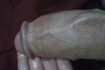 VEINY
