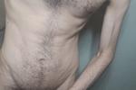 Hairy
