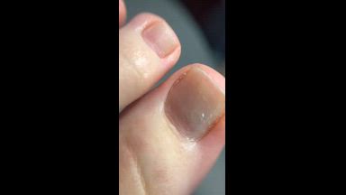 natural toenails