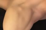 Bottom