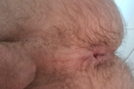 Asshole