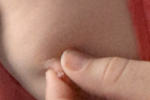 Nipple