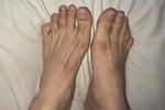 axel perrís — Feet