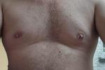 piercing