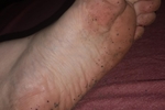 dirty feet