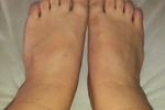 feet