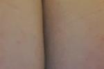 close bum