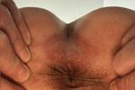 HOLE