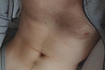 of