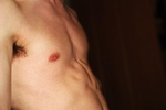 Chest