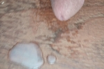my dick pics