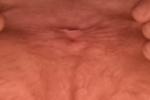 ass hole