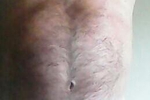 Hairy