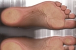 scaner my feets