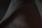 Teasers