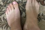 feet
