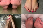 My Feet