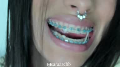 elastic in braces