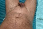 In pool