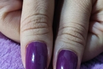 thumbs/nails