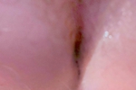My Ass
