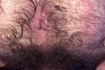 My furry hole