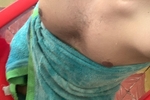 body