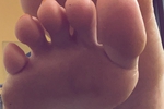 Toes and Soles