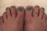 Feet