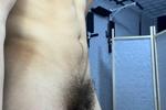 hairy pubis