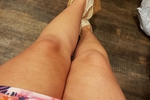 Legs